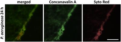 In vitro Activity of Antimicrobial Wound Dressings on P. aeruginosa Wound Biofilm